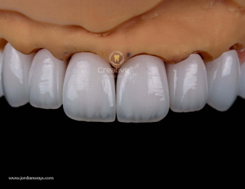 Creative Arts Dental Lab